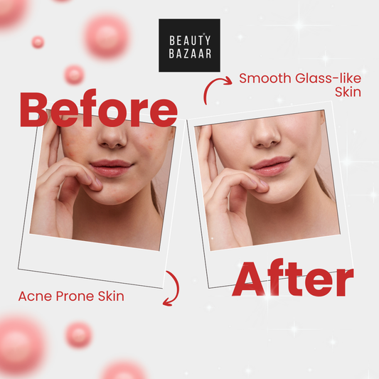 ✨😲 The Secret to Acne-Free Glass Skin: K-Beauty Guide Revealed
