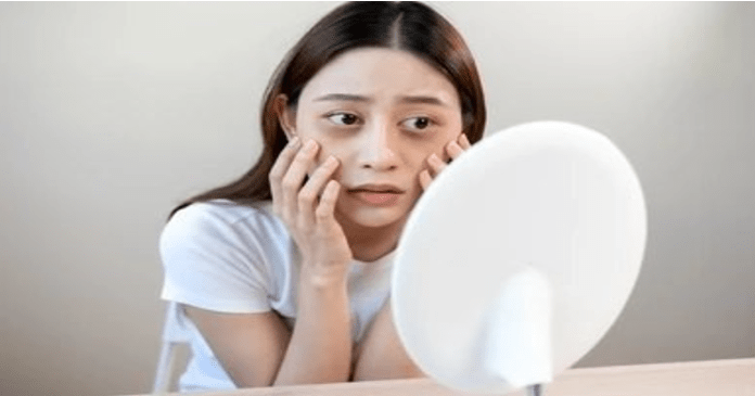 Causes of Bags Under Eyes: Genetics, Diet, and Allergies - AU Beauty Bazaar