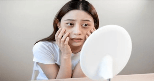 Causes of Bags Under Eyes: Genetics, Diet, and Allergies - AU Beauty Bazaar