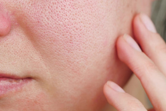 How to Minimize Enlarged Pores: Best Products and Tips for Smooth Skin - AU Beauty Bazaar