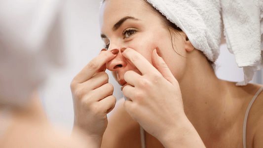 What to Do After You've Popped a Pimple: A Post-Care Guide - AU Beauty Bazaar