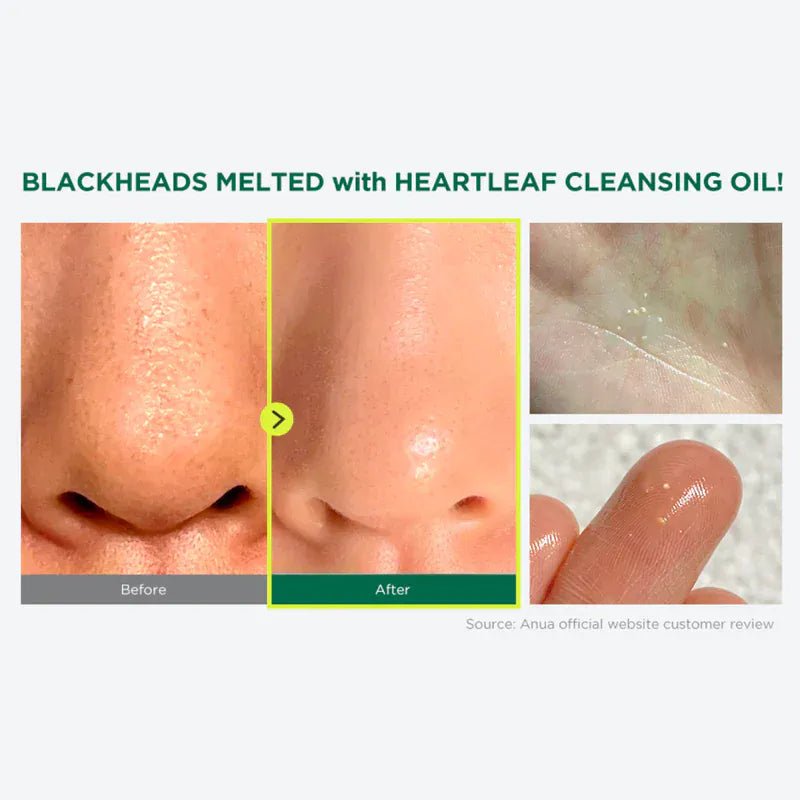 Anua - Heartleaf Pore Control Cleansing Oil Mini - 20ML - AU Beauty Bazaar