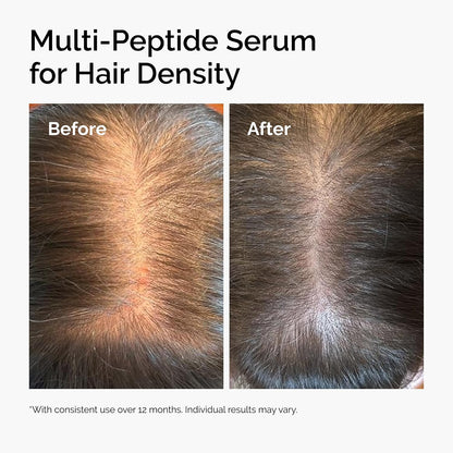 The Ordinary Multi-Peptide Serum for Hair Density 30mL