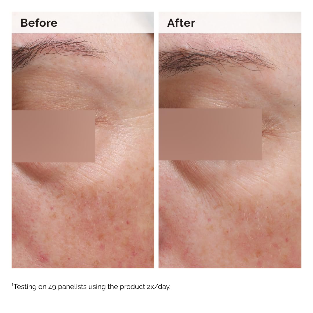 The Ordinary Niacinamide 5% Face and Body Emulsion 100mL