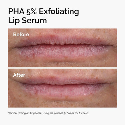 The Ordinary PHA 5% Exfoliating Lip Serum 15mL