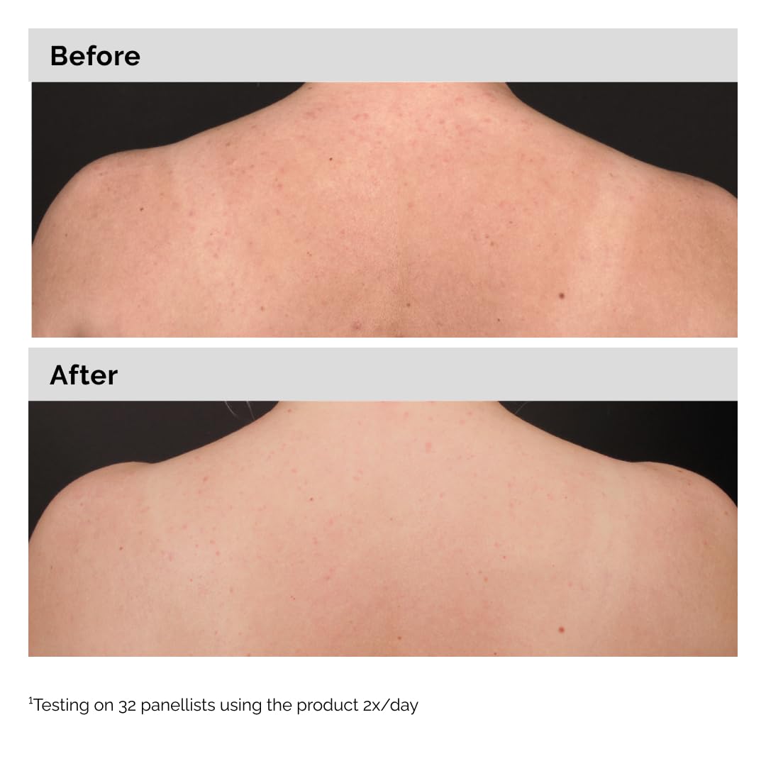 The Ordinary Salicylic Acid 0.5% Body Serum 240mL