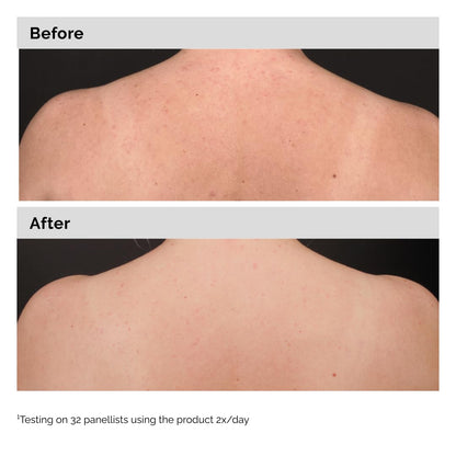 The Ordinary Salicylic Acid 0.5% Body Serum 240mL