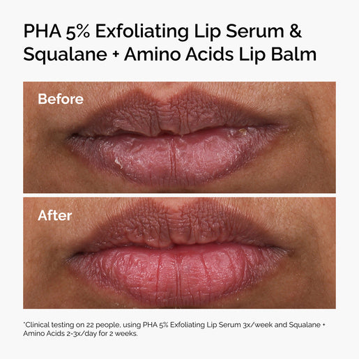 The Ordinary Squalane + Amino Acids Lip Balm 15mL