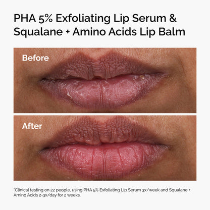 The Ordinary Squalane + Amino Acids Lip Balm 15mL