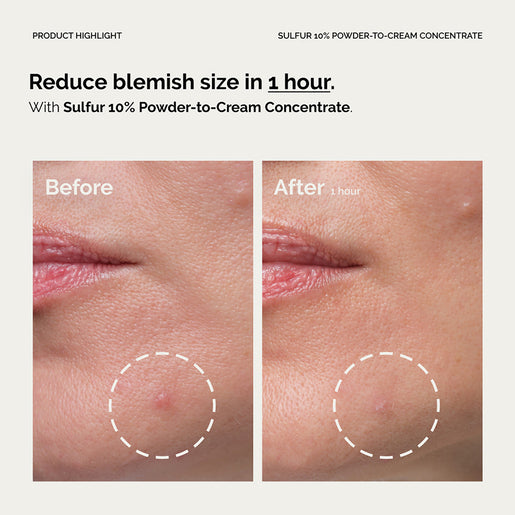 The Ordinary Sulfur 10% Powder-to-Cream Concentrate 5g