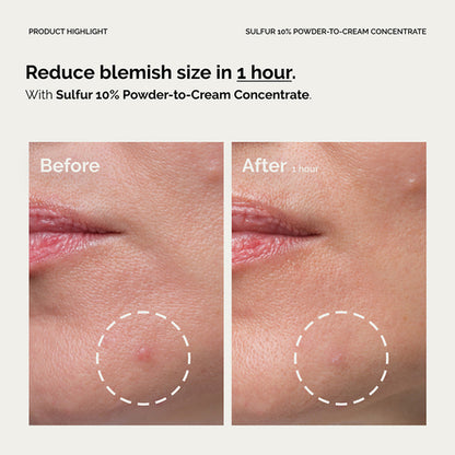 The Ordinary Sulfur 10% Powder-to-Cream Concentrate 5g